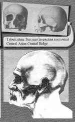 Tuberculum Turcum.jpg