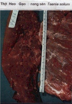 taeniasoliumcyst-3.jpg