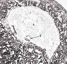 ch11aimg3 2 - Embryology Timing