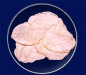 Appalam_Also_Called_Popadoms_Pappads_-1.jpg