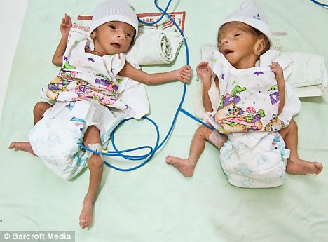 article103172201D7551100000578372 468x34 1 - World's oldest mother gives birth to twins at 70!!!!!!!!