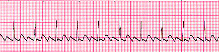 Flutter 1 - The Medical student Review