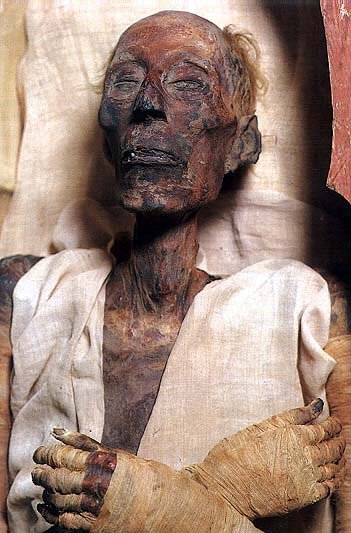 Ramesses20II20mummy2 1 - Dead body of Pharaoh