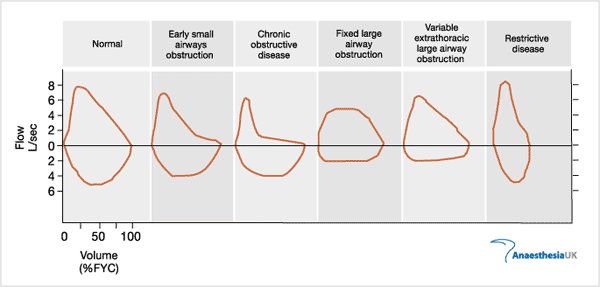 flow volume 1 - The Medical student Review