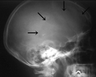 XraySkullArrowGIF 1 - The Medical student Review