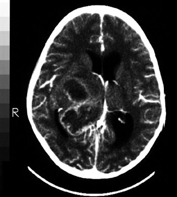 gross2 1 - The Medical student Review