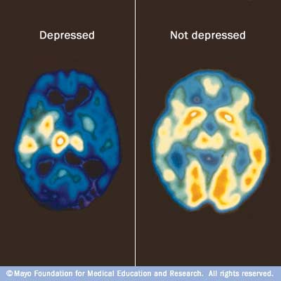 1053332 org 1 - Muslims using Western Psychology and Mental Illness: Permissible or lies?