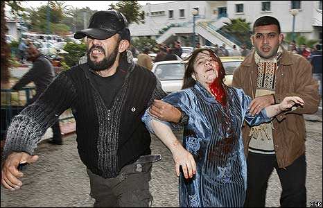 _45329607_wounded_afp466-1.jpg