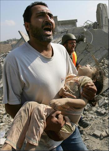 child_injured_in_israeli_attack_on_the_g-1.jpg