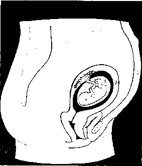 fetus-1.gif