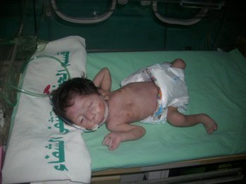 picphpf8mariangaza4 1 - Israel gives birth to strange creatures in Gaza´s hospitals
