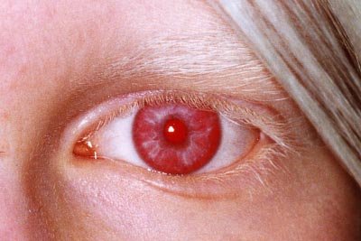 Albino400-1.jpg