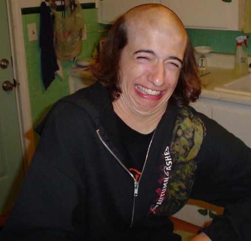 FUNNYPICTURESuglybaldmen-1.jpg