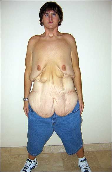 fat_06-1.jpg