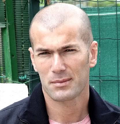zinedine_zidane_baldhairstyle-1.jpg