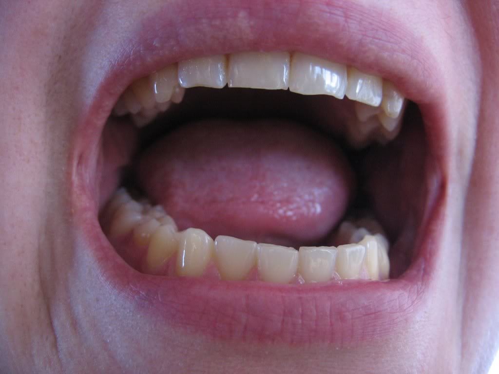 screaming_mouth_open-1.jpg