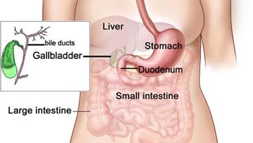 gallbladderstones-1.jpg