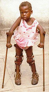 polio_47-1.jpg