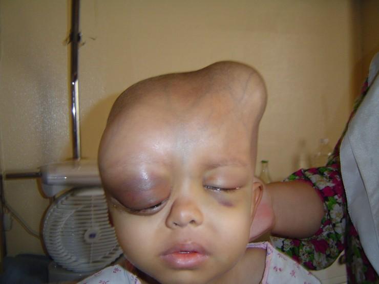 deformed20child-1.jpg