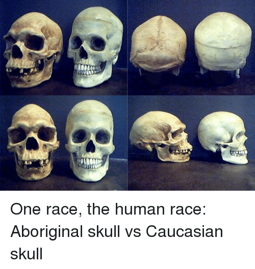 oneracethehumanraceaboriginalskullvscauc-1.png